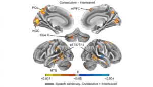 Brain scans for multitasking study