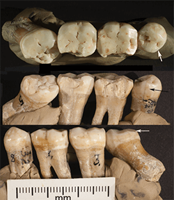 Neanderthal teeth used in University of Kansas study