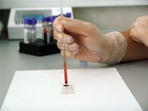 Scientist working with a blood sample in a lab