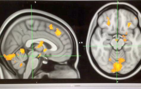 Brain scan for music study