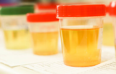 Urine samples