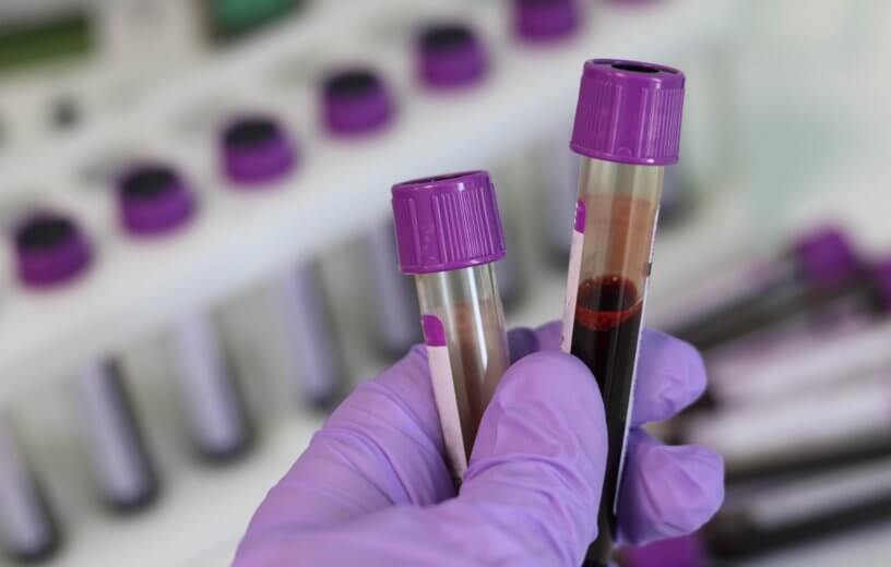 Blood test tubes in lab
