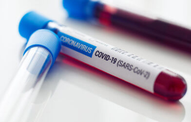 Coronavirus / COVID-19 Blood sample