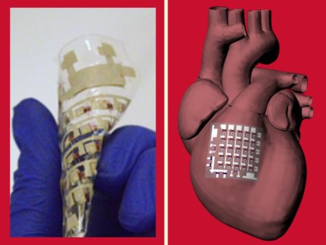 Heart Technology