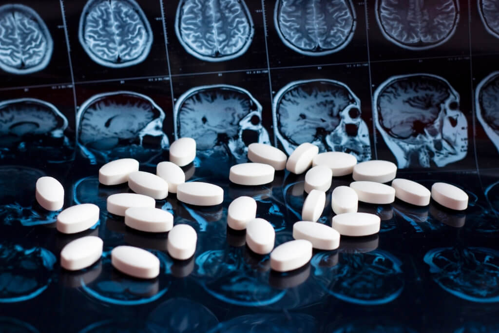Medicine, pills on top of brain MRI scans
