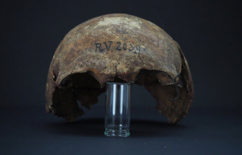 Black death plague found in skull