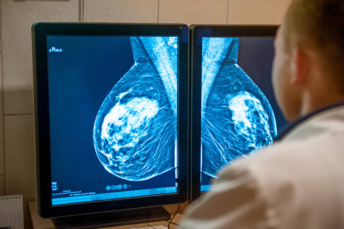 Doctor viewing mammogram breast cancer screening