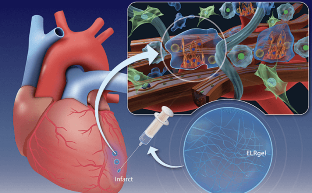 Hydrogel heart injection