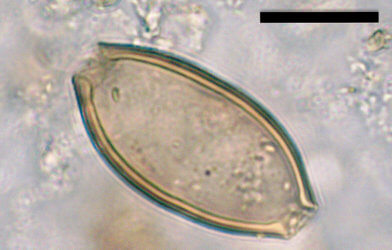 Microscopic egg of whipworm