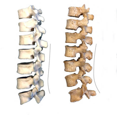 Lower back bones of a Neandertal