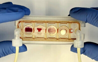 Organs on a chip