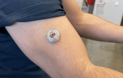 Wearable technology: health tracker on arm