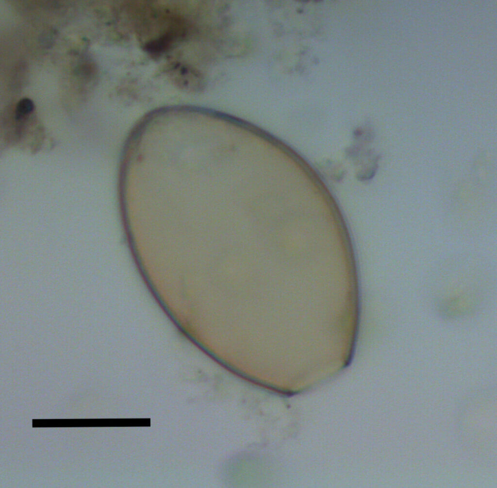 Microscopic egg of fish tapeworm found in dog coprolite.