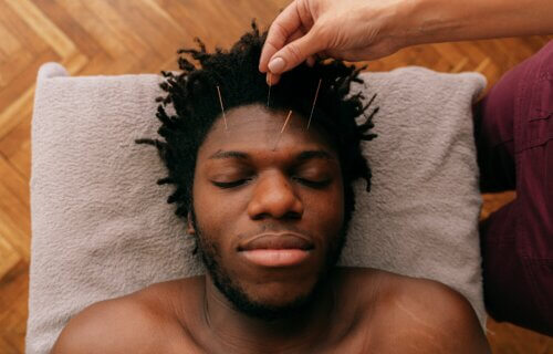 Man getting acupuncture