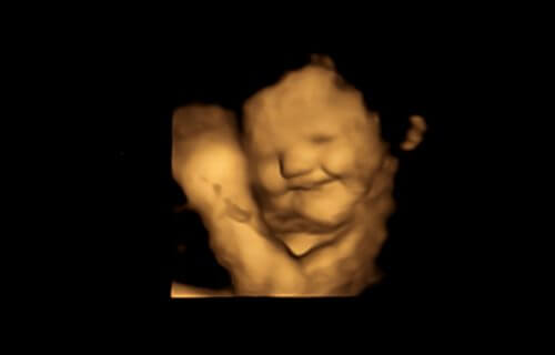 Laughter-face reaction scan image of fetus