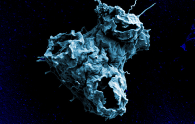The cell surface of a Naegleria gruberi amoeba
