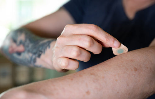 A microneedle patch tattoo is pressed to the skin.