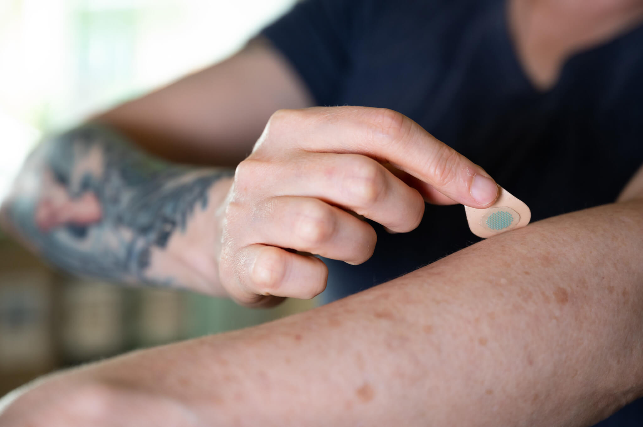 Tattoo 'patch' made from microneedles offers pain-free alternative to  getting inked - Study Finds