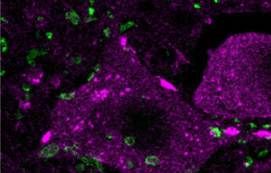 Epigenetic treatment in mice improves spinal cord regeneration after injury