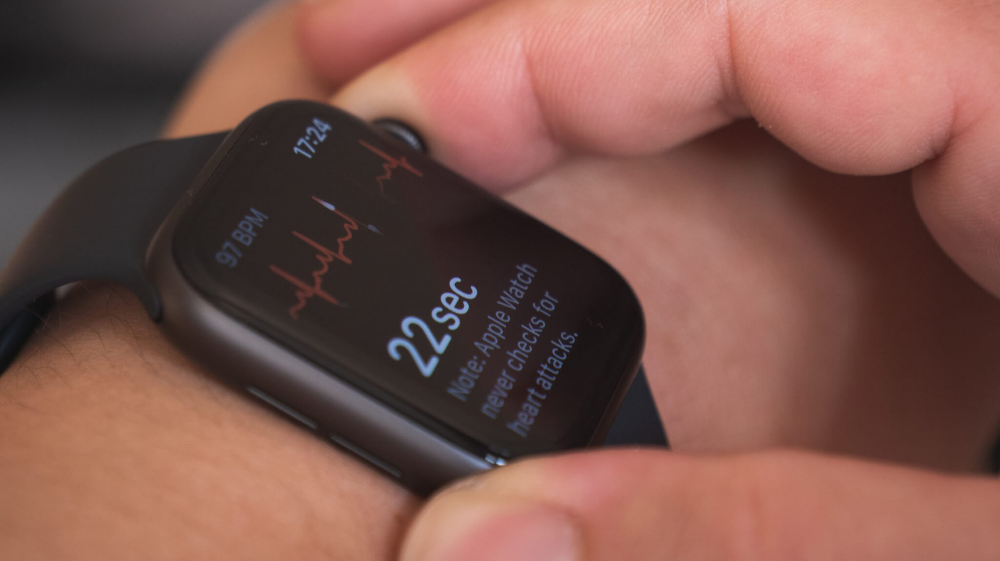 Apple Watch: Smartwatch wearable technology measuring heart rhythm via ECG