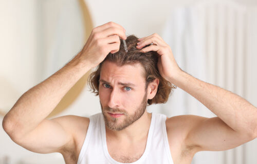 Man putting hair growth oil on his scalp