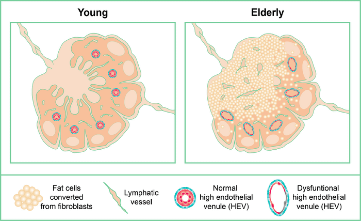lymph nodes turn to fat as people age