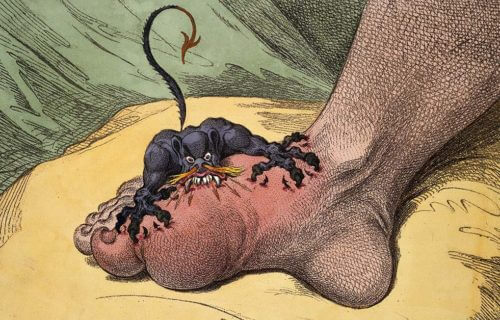 Have scientists found a new treatment for the ancient foot condition gout?