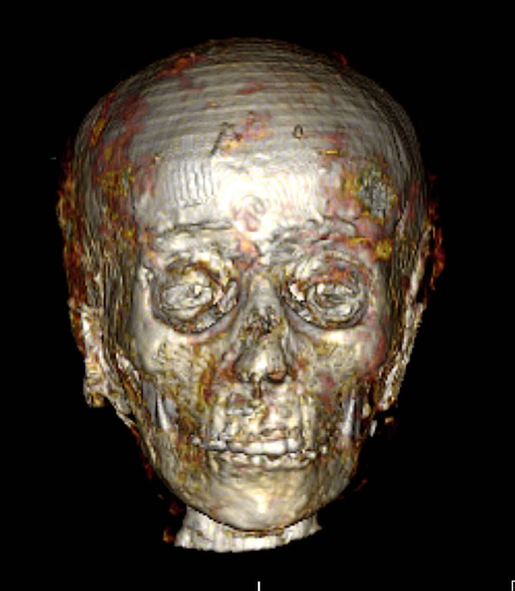 The mummy's face on CT scans.