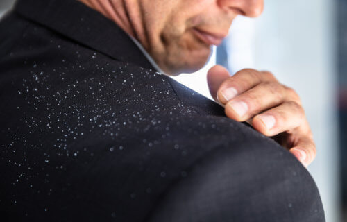 Man brushing dandruff flakes off of his suit jacket