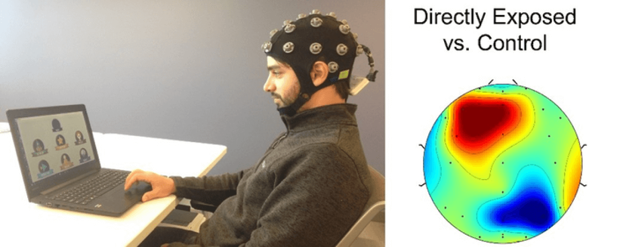 A man undergoes brain scanning while looking at a laptop.