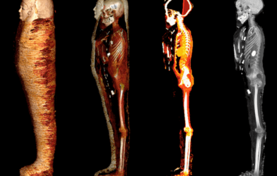 4 images of a mummy showing his skeleton and outer wrappings