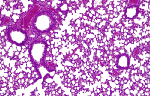 Microscopic view of a lung infection in a mouse