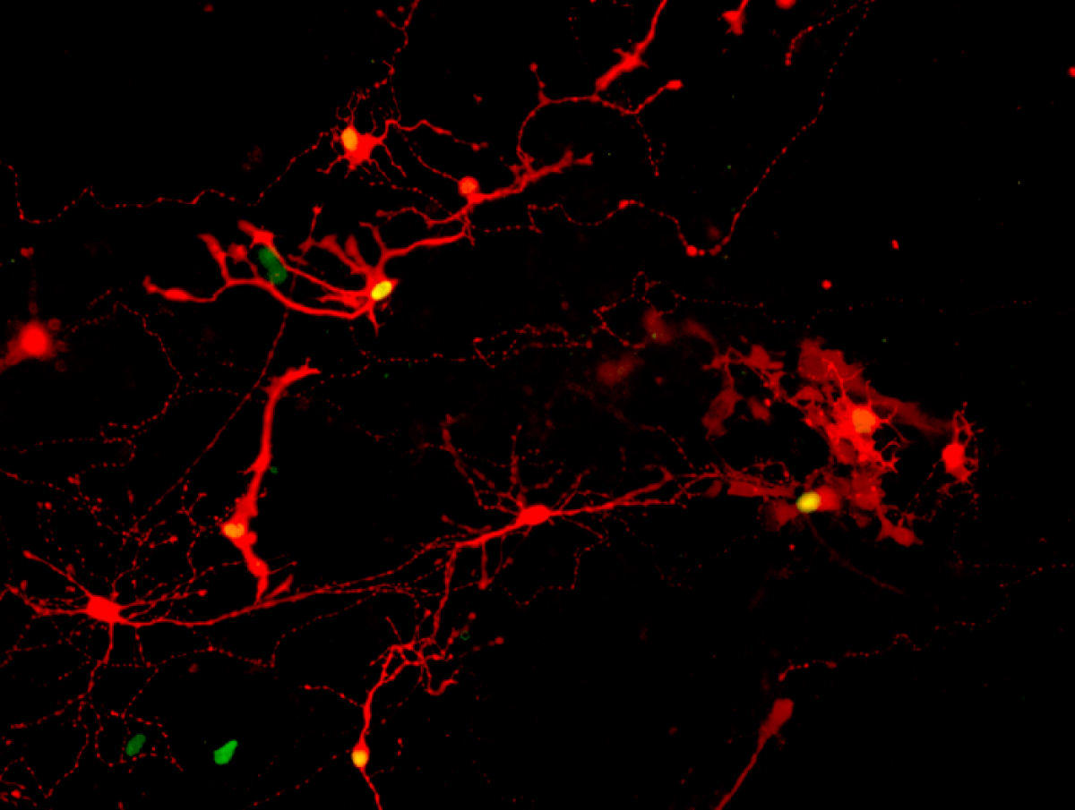 Image of synapses connecting pairs of retinal cells.