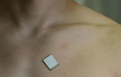 A small patch on a man's chest