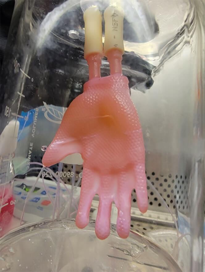 Creating a "glove" of engineered skin for grafting.