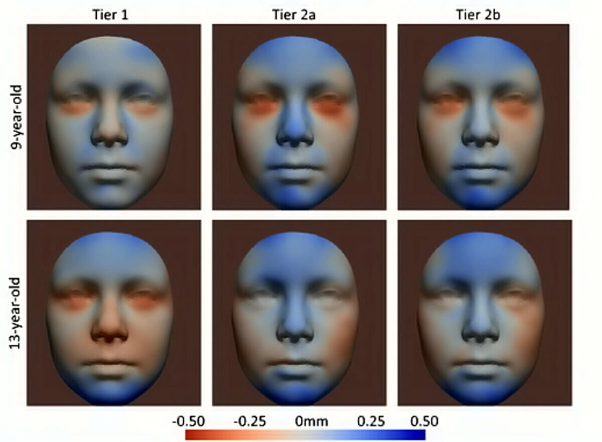 Facial development linked to alcohol consumption