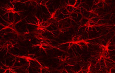 brain astrocytes