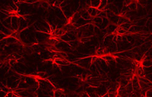 brain astrocytes