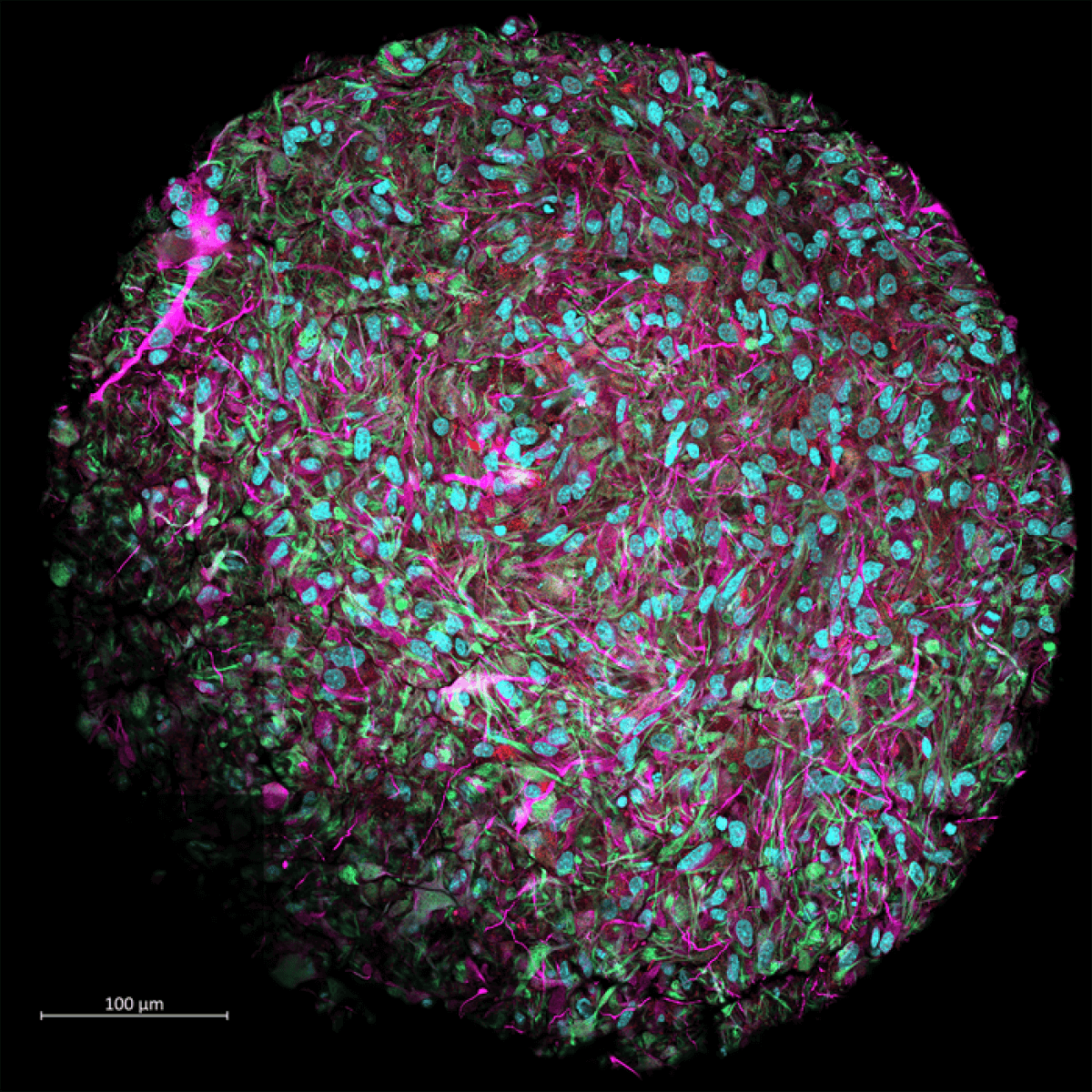 magnified image of a brain organoid
