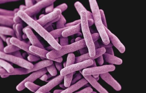 tuberculosis bacteria