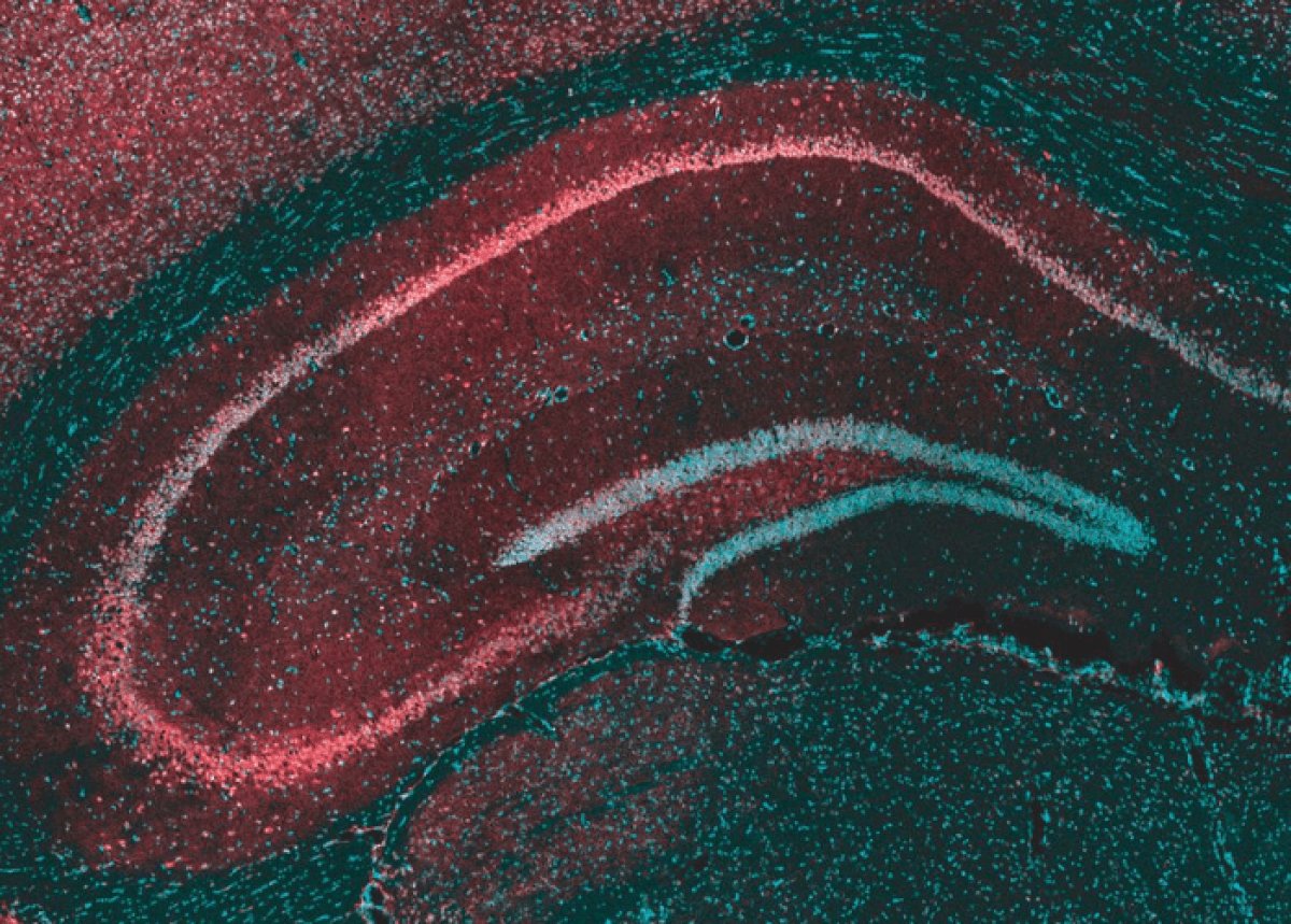 microscopic image of the hippocampus