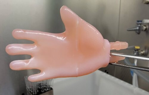 Growing human skin in the lab in the form of a hand