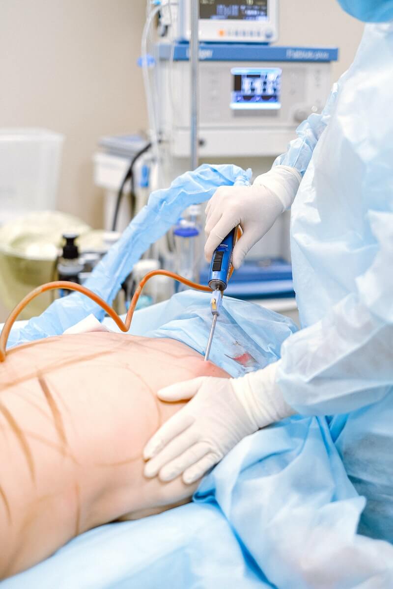 Medical Professional Doing Liposuction procedure