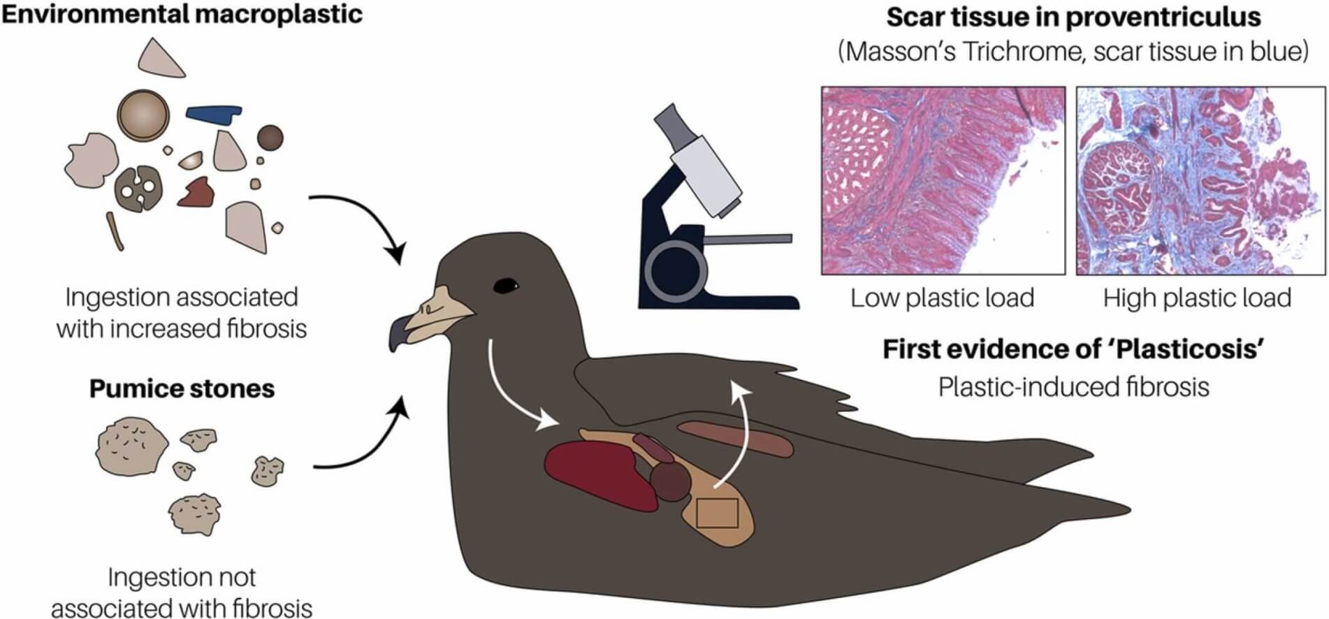 plasticosis in a seabird