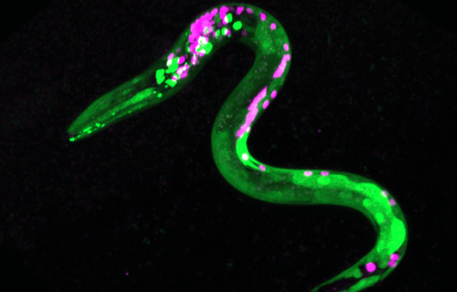 Image of worm that is genetically engineered so that certain neurons and muscles are fluorescent