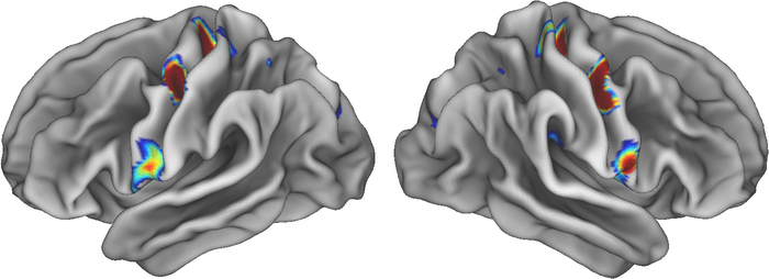 brain scan highlighting movement areas