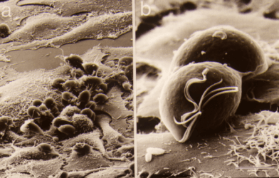 image of numerous Trichomonas vaginalis organisms