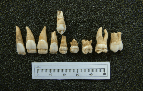 dental remains of child laborers