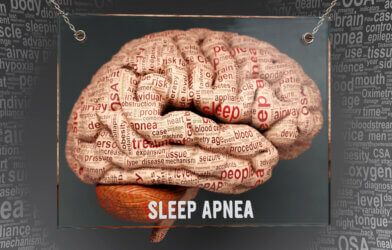 Sleep apnea brain anatomy