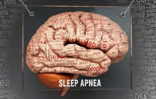 Sleep apnea patients show more signs of Alzheimer's and a shrinking ...